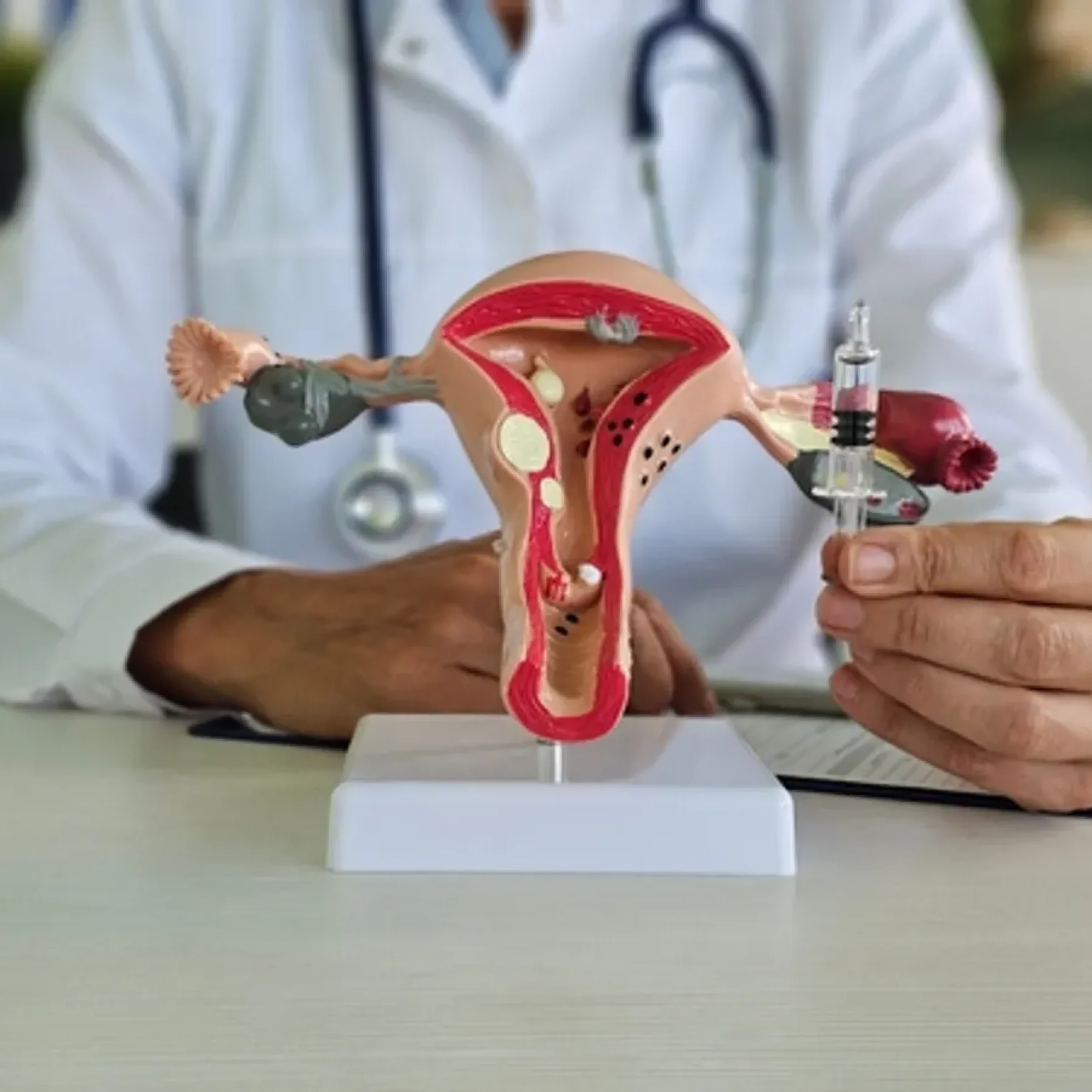 IVF treatment in Gwalior